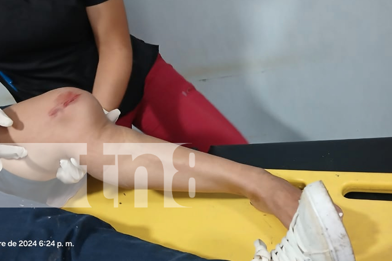 FOTO: Mujer resulta lesionada tras perder el control de su motocicleta en Bocana de Paiwas/TN8