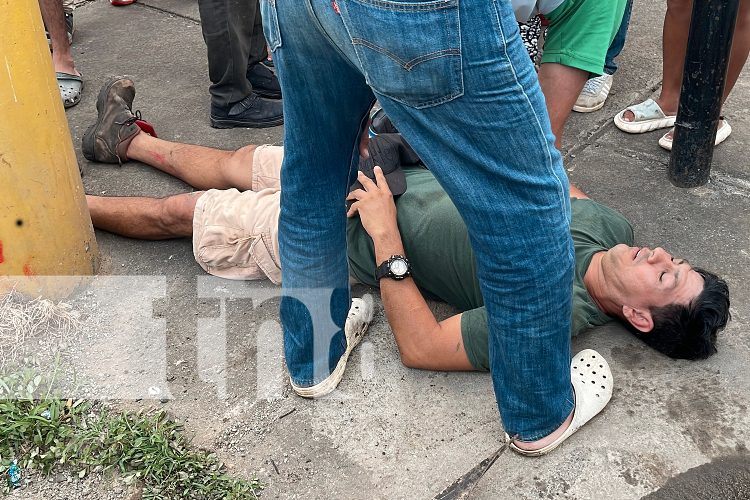 Foto: Cuádruple accidente en Juigalpa: camioncito, cabezal, motocicleta y camioneta involucrados. Cuatro heridos y cuantiosos daños. /TN8